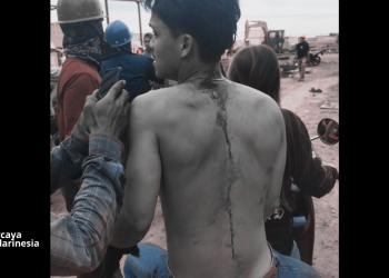 Korban kekerasan di PT IPIP Kolaka. Foto: Dok Istimewa/kendarinesia